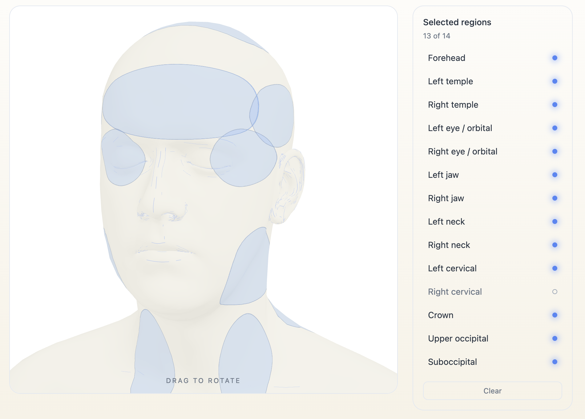 Current 3D headache map with thirteen of seventeen anatomical regions selected